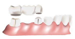 Dental Topics for Teen
