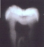 Dental Care Kids Pediatric & Orthodontic dentistry - Diagodent xray