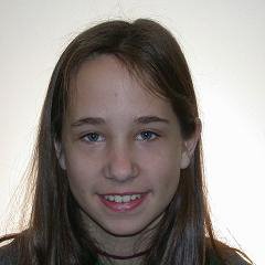 Braces after photo #2a