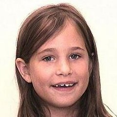Braces before photo #2a