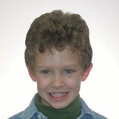 Braces before photo #3a